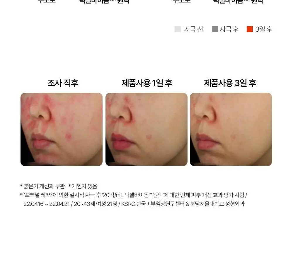 [총40ml/장벽강화세럼] 퍼셀 20억/mL 픽셀바이옴 유산균 원액 20ml 더블 기획 상세페이지 37